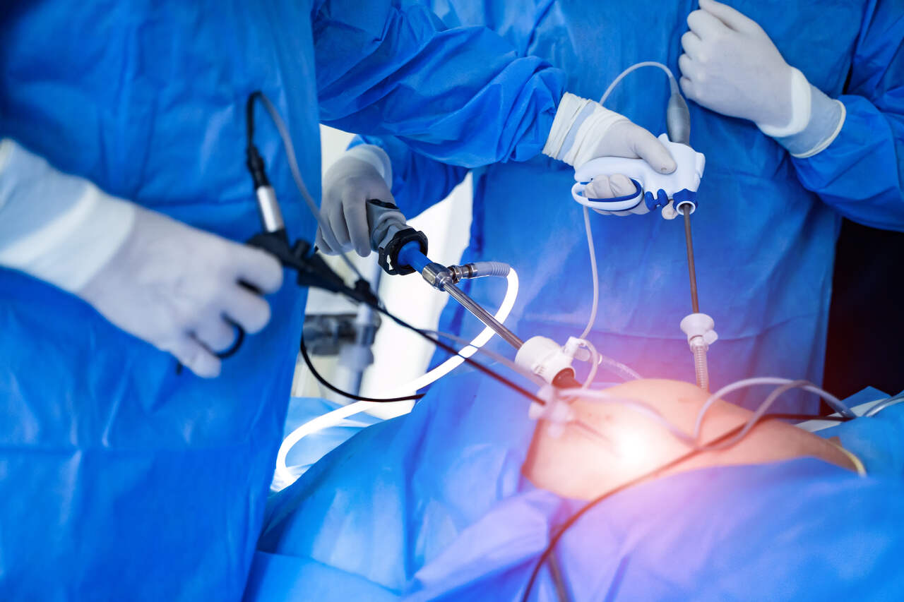 Vantagens da cirurgia laparoscópica para o câncer de próstata