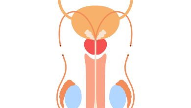 Ainda tem dúvidas sobre vasectomia? O que você precisa saber antes de decidir!