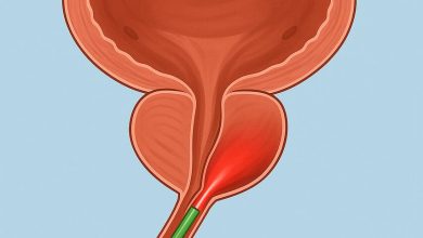 Conheça a cirurgia a laser que devolve o fluxo urinário e a qualidade de vida